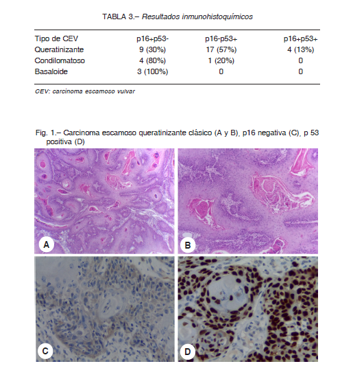 El diagnóstico y tratamiento de enfermedades de la mujer. Fig. 270.  Carcinoma]de Labium Minus, comienzo. (Hirst, enfermedades ofWomen.)  CARCINOMA DE LABIUM 205. Fig. 271. Carcinoma de Labium en un escenario  mayor.(Hirst